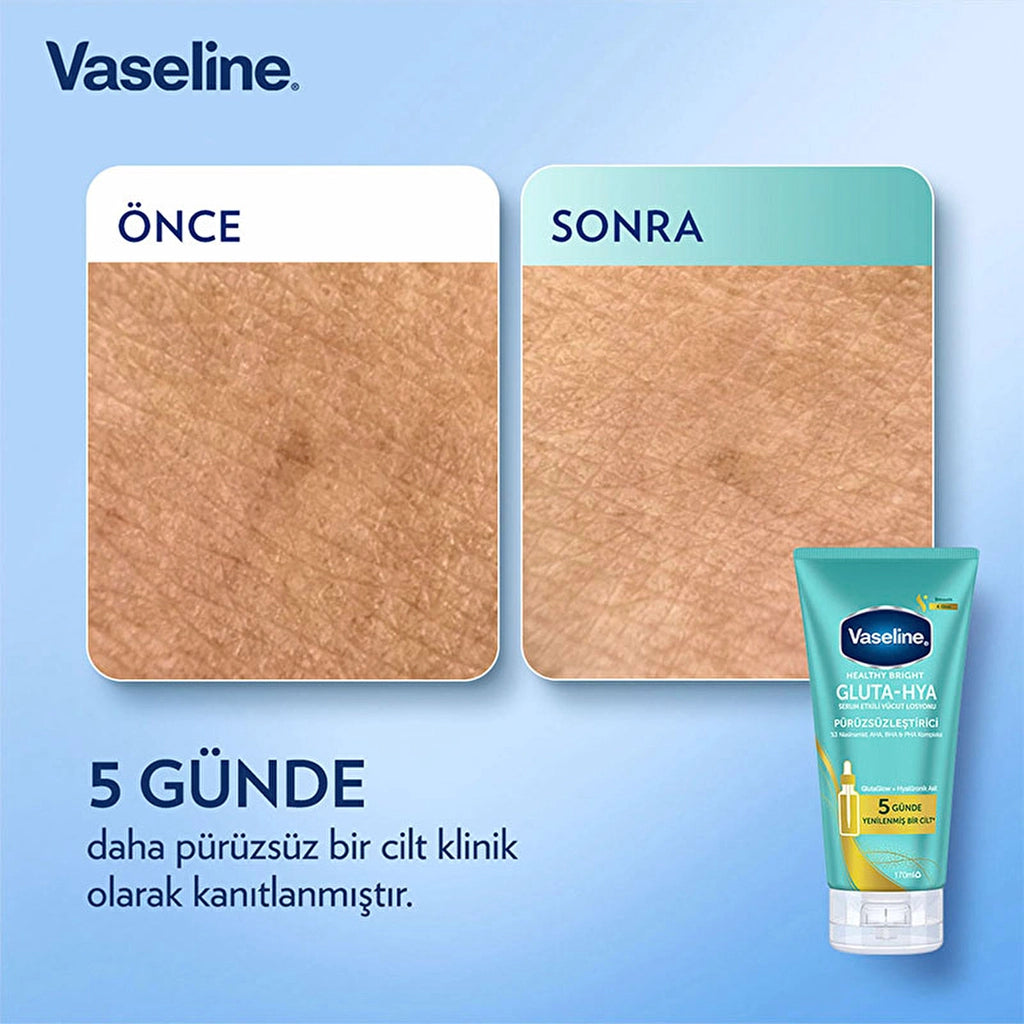 Vaseline Gluta-Hya Serum Effective Body Lotion Smoothing 170 ml