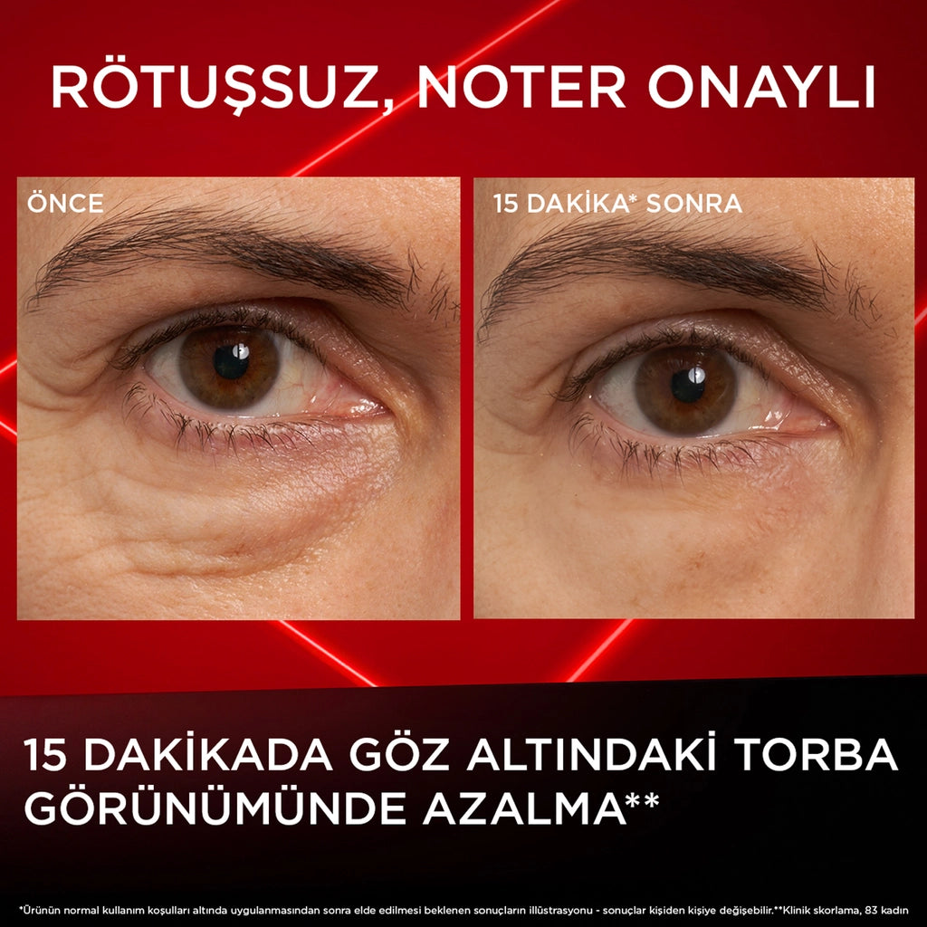 Loreal Paris Revitalift Laser Eyebag Instant Eraser Effective Eye Cream Against Under-Eye Bag Appearance
