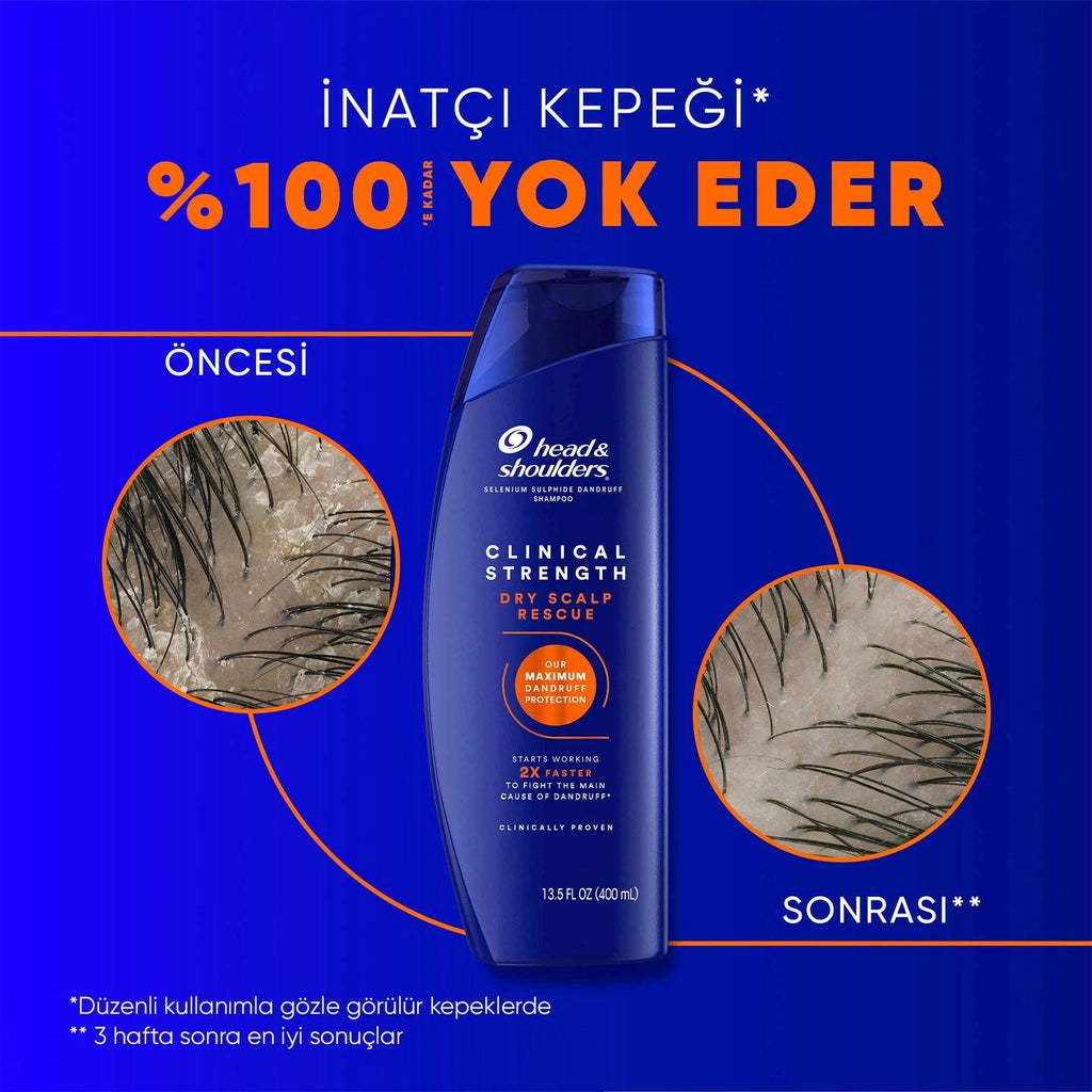 Head &amp; Shoulders Clinical Strength Dry Scalp Rescue Shampoo for Dry Scalp 400 ml