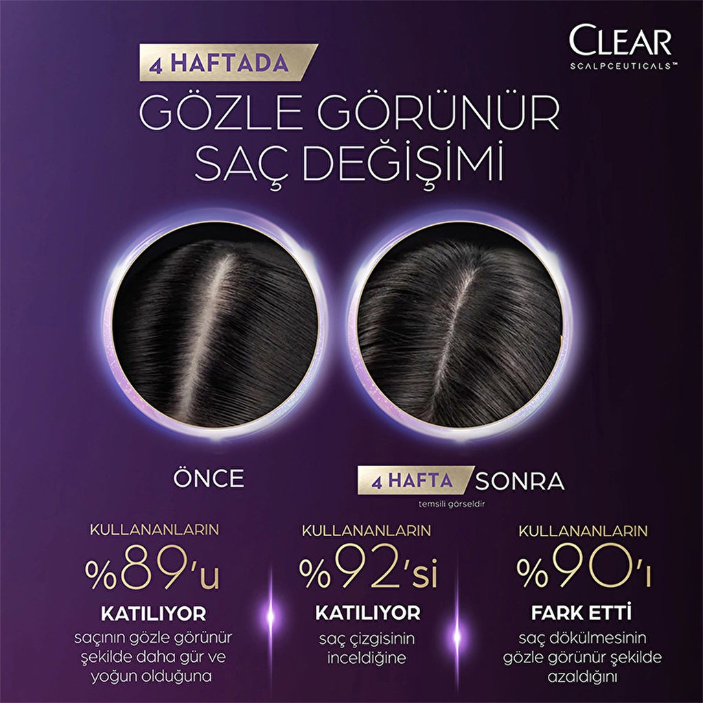Clear Scalpceuticals Hair Care Shampoo Against Hair Loss 300 ml