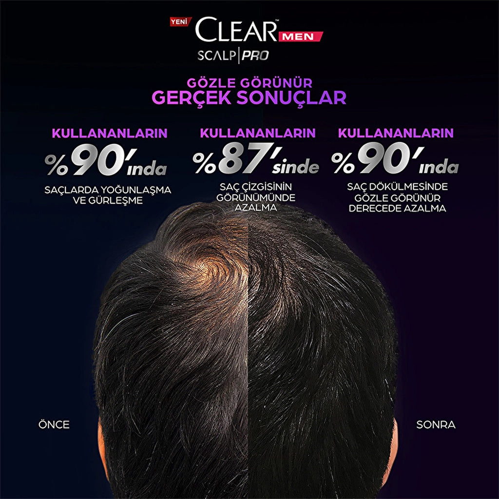 Clear Men Scalp Pro Strengthening Shampoo Effective Against Hair Loss and Dandruff 300 ml